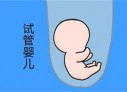 培养南通捐卵宝宝艺术细胞的小技巧